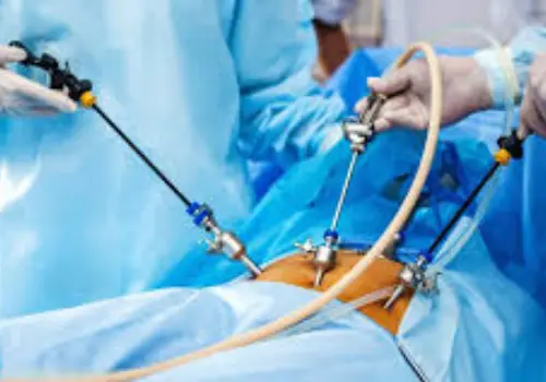 Laparoscopic Surgery in Thane