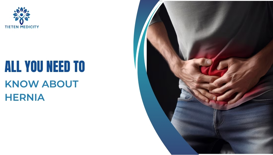 All You Need to Know about Hernia