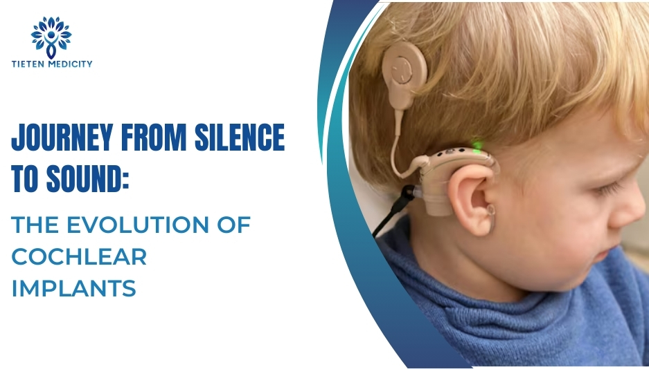 Journey From Silence to Sound: The Evolution of Cochlear Implants