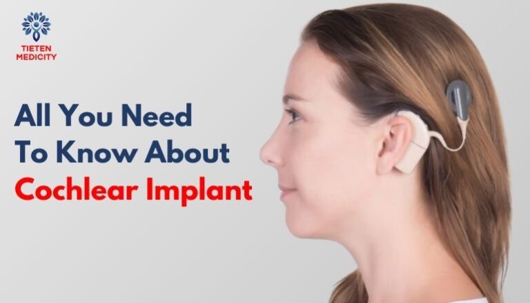 Cochlear Implant Surgery Doctors in Thane | Tieten Medicity