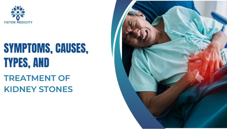 Symptoms, Causes, Types, and Treatment of Kidney Stones