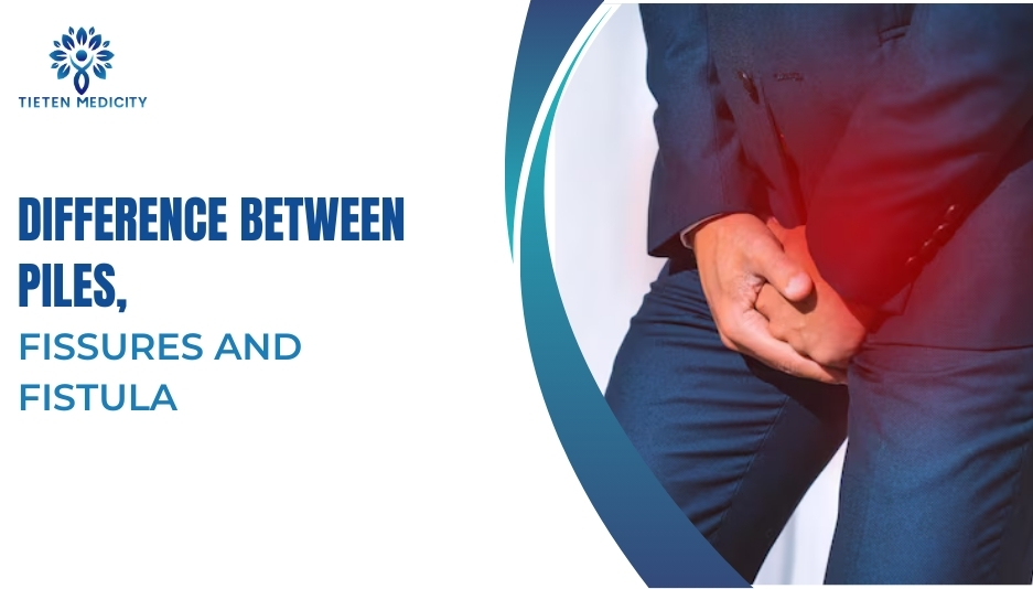 Difference Between Piles Fissures And Fistula Explained